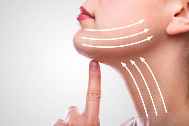 Facelift in Riyadh: A Complete Guide to Advanced Skin Renewal Solutions