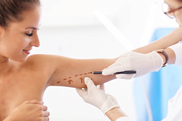 Arm Lift Surgery for a Sleeker Appearance After Major Weight Changes