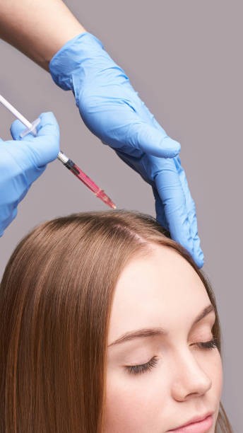 PRP Hair Treatment for Managing Hair Shedding and Progressive Thinning
