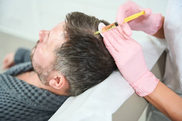 PRP Hair Treatment for Supporting a Fuller Looking Crown Area